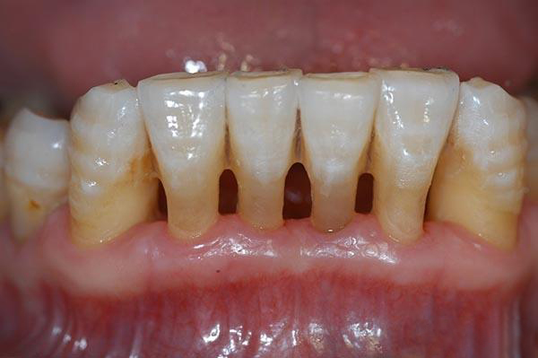 舟山最新24小时牙医在线咨询方法分析(最方便真实的舟山有没有24小时牙医方法)